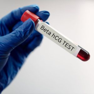 Pregnancy test in blood vs Urine